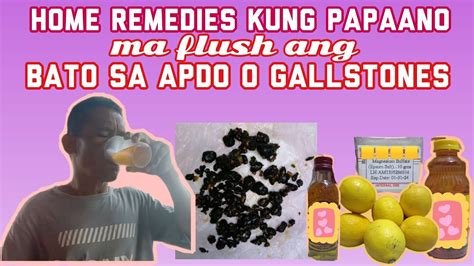 bato sa apdo pagtunaw sa natural na paraan|BATO SA APDO .